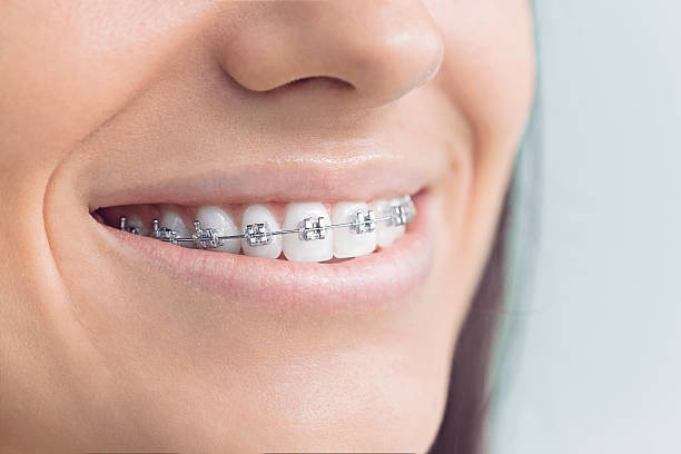 Best Dental Implants  in Eastlake, OH